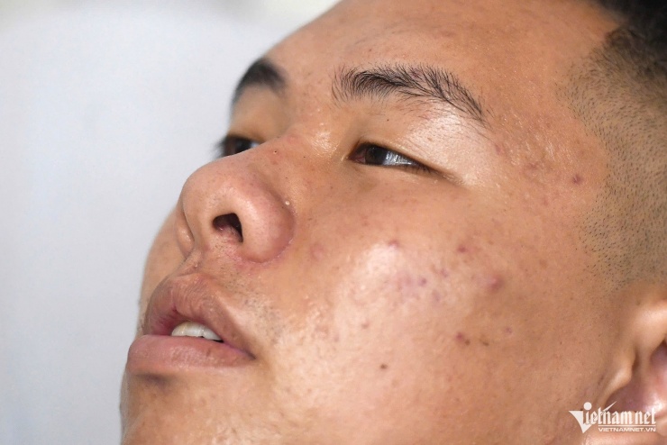 Anh Tú chưa hết bàng hoàng sau khi sự việc xảy ra. Ảnh: Thạch Thảo
